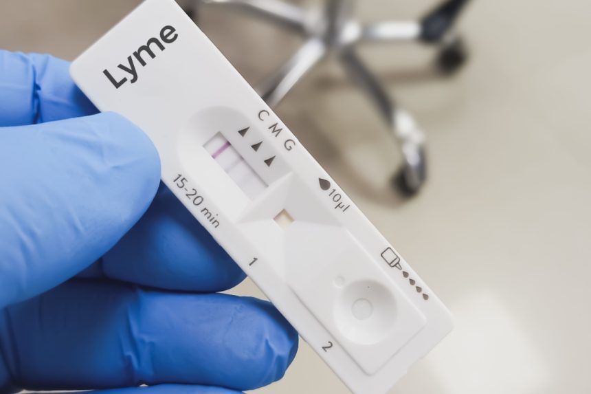 [p]-boala-lyme:-ce-este-si-cum-se-trateaza-infectia-cauzata-de-capuse-–-hotnews.ro