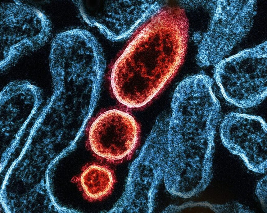 controale-amanuntite-in-aeroporturi-din-asia-dupa-ce-india-anunta-noi-infectii-cu-virusul-nipah