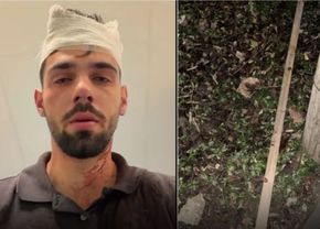 socant-scandal!-doi-fotbalisti-de-la-poli-timisoara,-acuzati-ca-au-snopit-in-bataie-un-tanar-de-19-ani:-huliganii-mi-au-nenorocit-copilul!-parul-cu-care-l-au-lovit-e-plin-de-sangele-lui