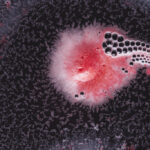 o-bacterie-comuna-in-ochi-ar-putea-provoca-alzheimer