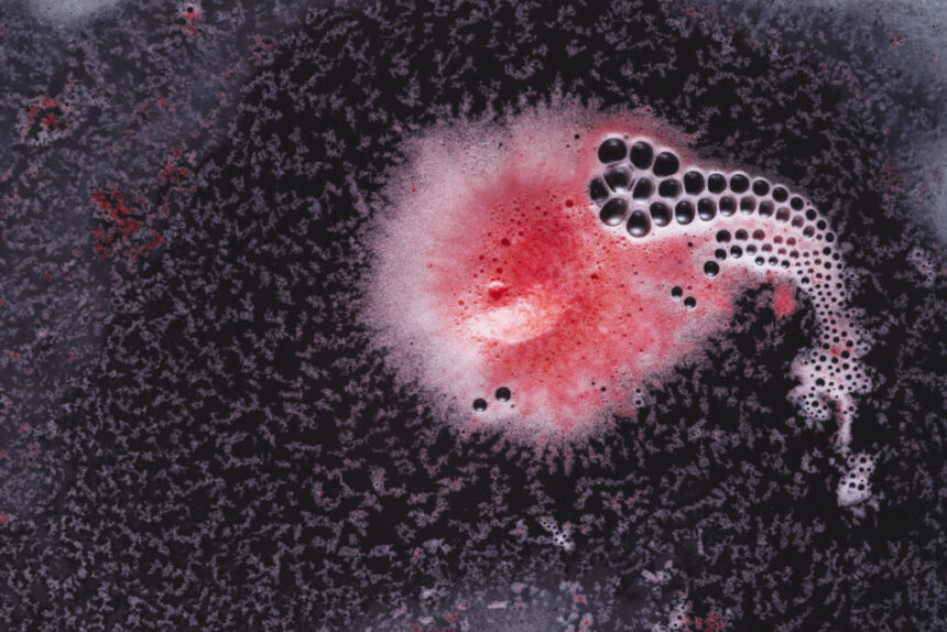 o-bacterie-comuna-in-ochi-ar-putea-provoca-alzheimer